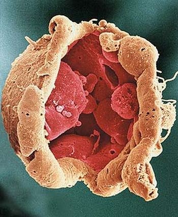 EmbriÃ£o humano na fase de blastocisto